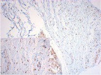 CHOP Recombinant Rabbit Monoclonal  Antibody