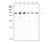 NCAPD2 Recombinant Rabbit Monoclonal  Antibody