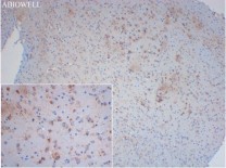 NLRP3 Recombinant Rabbit Monoclonal Antibody