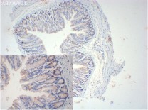 NLRP3 Recombinant Rabbit Monoclonal Antibody