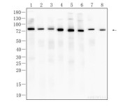 FACL4 Recombinant Rabbit Monoclonal Antibody