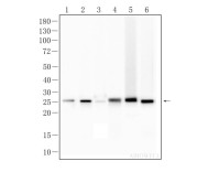 HPRT Recombinant Rabbit Monoclonal  Antibody