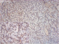 Histone H3 Recombinant Rabbit Monoclonal Antibody