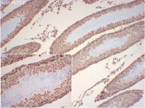 Histone H3 Recombinant Rabbit Monoclonal Antibody