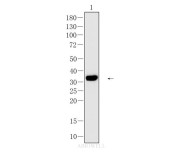 HLA-DR Recombinant Rabbit Monoclonal Antibody