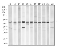 α-SMA Rabbit Polyclonal Antibody