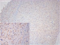 Nrf2 Rabbit Polyclonal Antibody