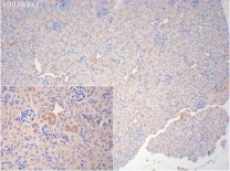 Nrf2 Rabbit Polyclonal Antibody