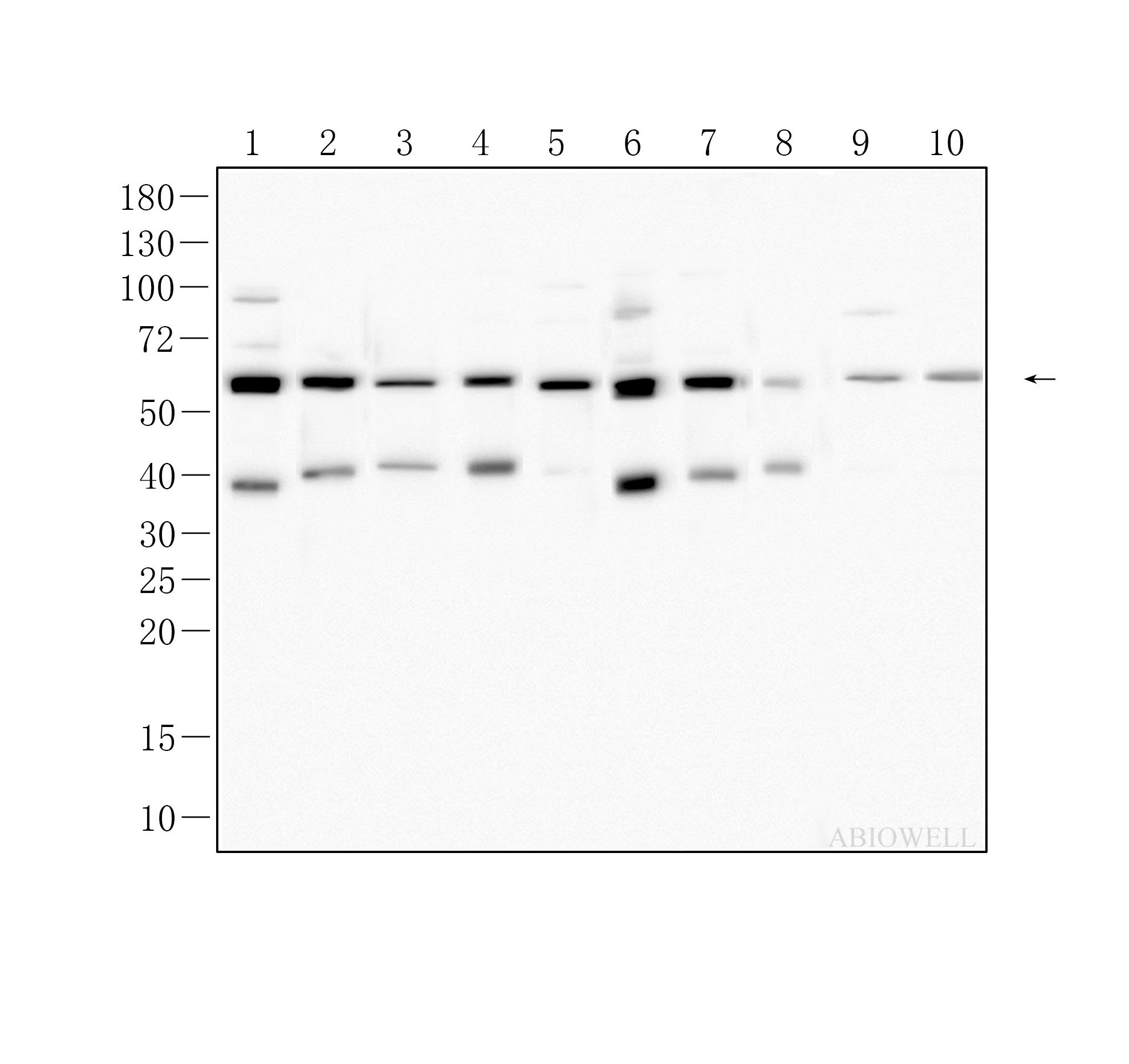 xCT/SLC7A11 Recombinant Rabbit Monoclonal Antibody