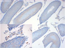 Granulin Recombinant Rabbit Monoclonal  Antibody