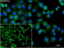 Cdk6 Recombinant Rabbit Monoclonal Antibody