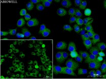 Galectin 8 Recombinant Rabbit Monoclonal  Antibody