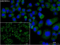 NCAPD2 Recombinant Rabbit Monoclonal  Antibody