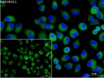 NLRP3 Recombinant Rabbit Monoclonal Antibody