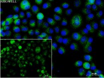 FACL4 Recombinant Rabbit Monoclonal Antibody