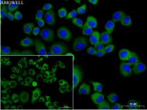 STAT3 Recombinant Rabbit Monoclonal Antibody