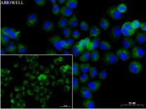 Ferritin Recombinant Rabbit Monoclonal  Antibody