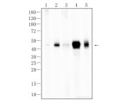 PD-L1 Recombinant Rabbit Monoclonal  Antibody