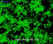 NCI-H2170+GFP（人肺癌细胞GFP标记细胞）