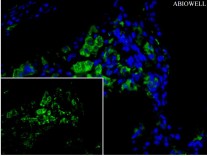 HPRT Recombinant Rabbit Monoclonal  Antibody