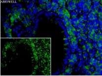 HPRT Recombinant Rabbit Monoclonal  Antibody