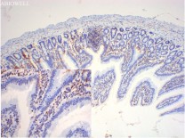 HMGB1 Recombinant Rabbit Monoclonal Antibody