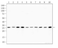 HMGB1 Recombinant Rabbit Monoclonal Antibody