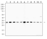 HMGB1 Recombinant Rabbit Monoclonal Antibody