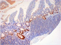 Galectin 8 Recombinant Rabbit Monoclonal  Antibody