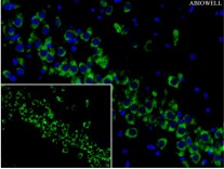 CHOP Recombinant Rabbit Monoclonal  Antibody