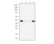 HLA-DR Recombinant Rabbit Monoclonal Antibody