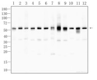 Parkin Rabbit Polyclonal Antibody