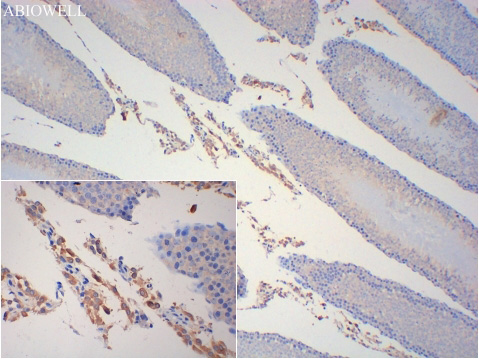 IFN-γ Rabbit Polyclonal Antibody - 3