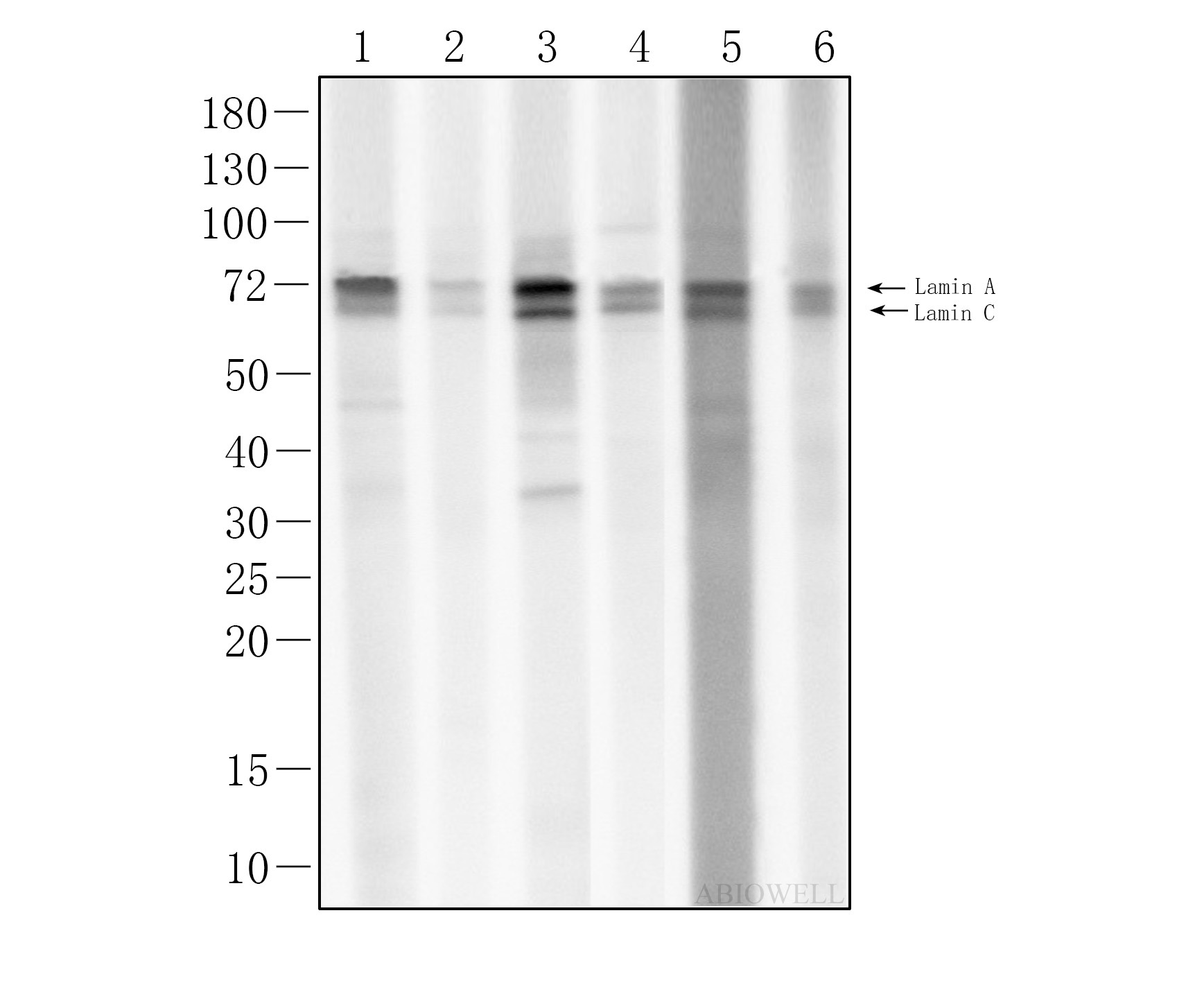 Lamin A/C Rabbit Polyclonal Antibody - 3