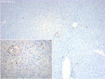 CD16 Recombinant Rabbit Monoclonal Antibody