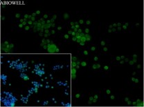 HMGB1 Recombinant Rabbit Monoclonal Antibody