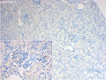 TBK1 Mouse Monoclonal Antibody