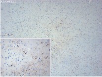 GFAP Recombinant Rabbit Monoclonal Antibody