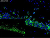 CHOP Recombinant Rabbit Monoclonal  Antibody