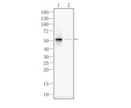 HNF-4-alpha Recombinant Rabbit  Monoclonal Antibody