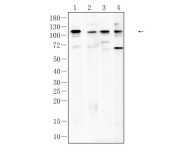 CD31 Recombinant Rabbit Monoclonal Antibody