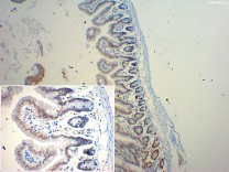 EZH2 Recombinant Rabbit Monoclonal Antibody