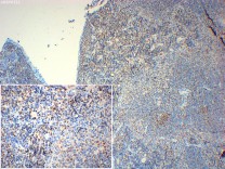 EZH2 Recombinant Rabbit Monoclonal Antibody