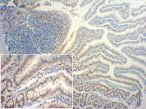 EZH2 Recombinant Rabbit Monoclonal Antibody