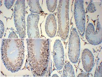 EZH2 Recombinant Rabbit Monoclonal Antibody