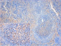 CD4 Mouse Monoclonal Antibody