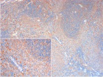 CD4 Mouse Monoclonal Antibody