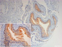 FIS1 Recombinant Rabbit Monoclonal Antibody