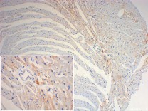 FIS1 Recombinant Rabbit Monoclonal Antibody