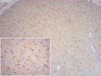 HLA-DR Recombinant Rabbit Monoclonal Antibody